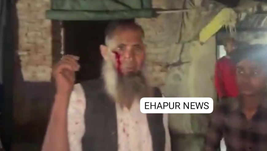 हापुड़: दो पक्षों में हुआ विवाद, एक दर्जन लोग घायल