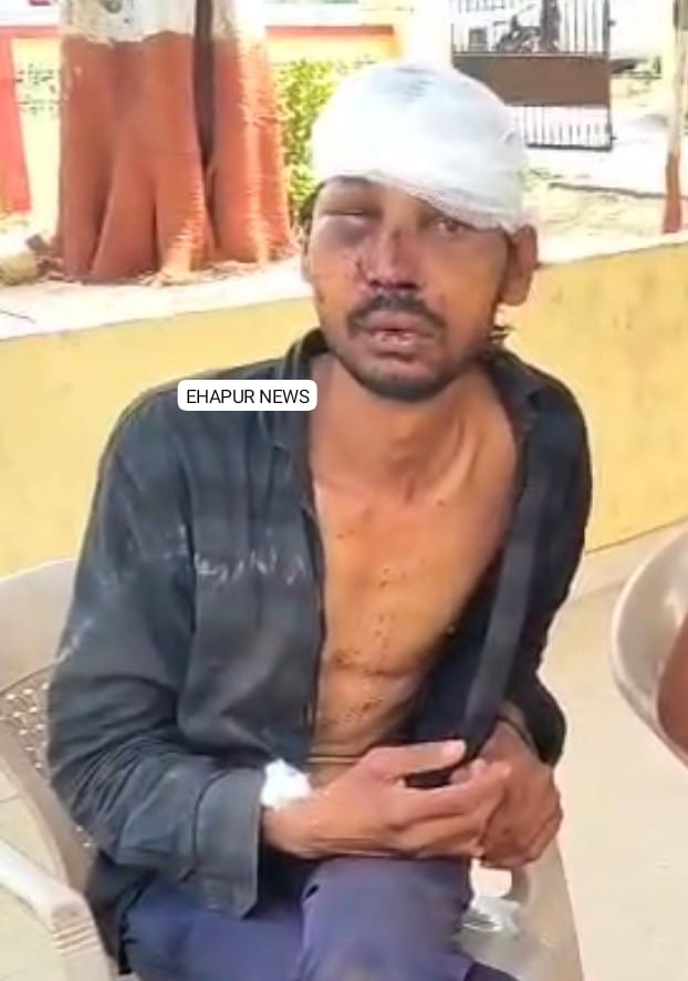 सामान खरीदने बाजार गए युवक को जमकर पीटा