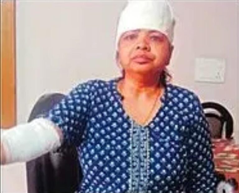 आवारा कुत्तों के झुंड ने किया महिला पर हमला