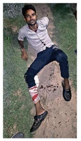 हापुड़ के ज्वेलर्स से भोजपुर में हुई लूट के मामले में दो बदमाशों को लगी गोली