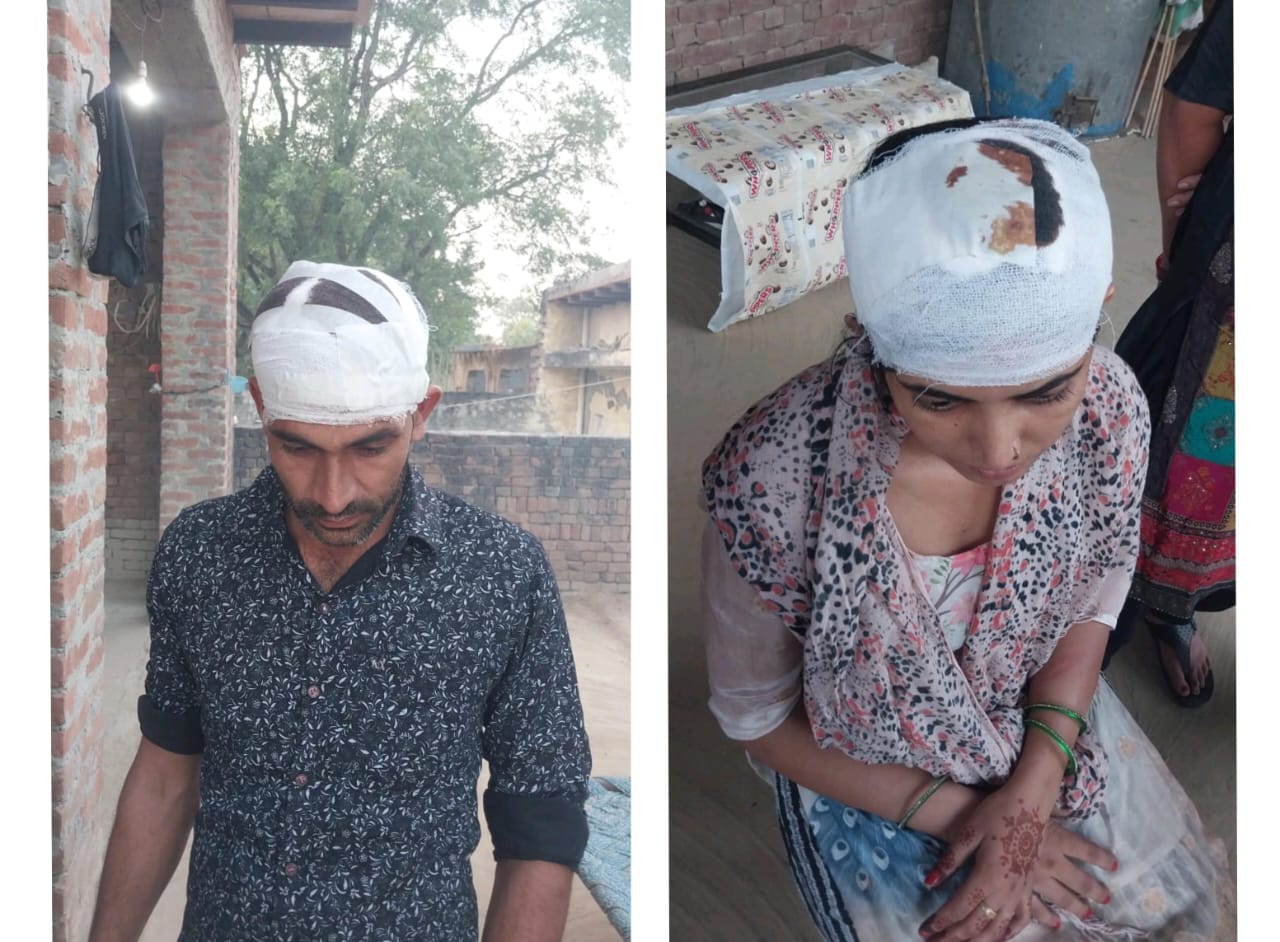 जमीनी विवाद को लेकर दो पक्षों में संघर्ष, महिला सहित दो घायल