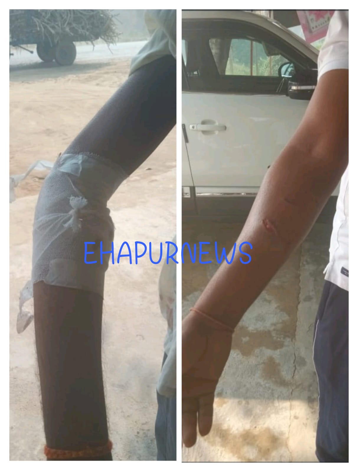 बहादुरगढ़ क्षेत्र के तीन गांव में बंदरों का आतंक, पिछले 10 दिनों में 40 को काटा