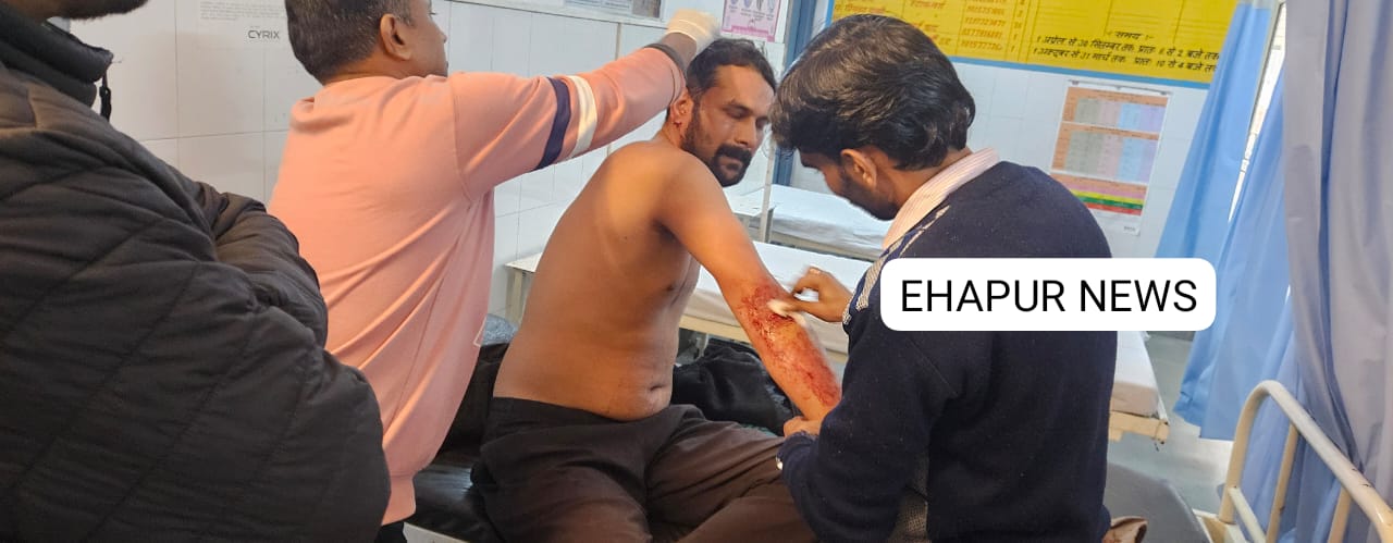 पिलखुवा: जिम में दो भाइयों ने युवक पर किया डंबल से हमला