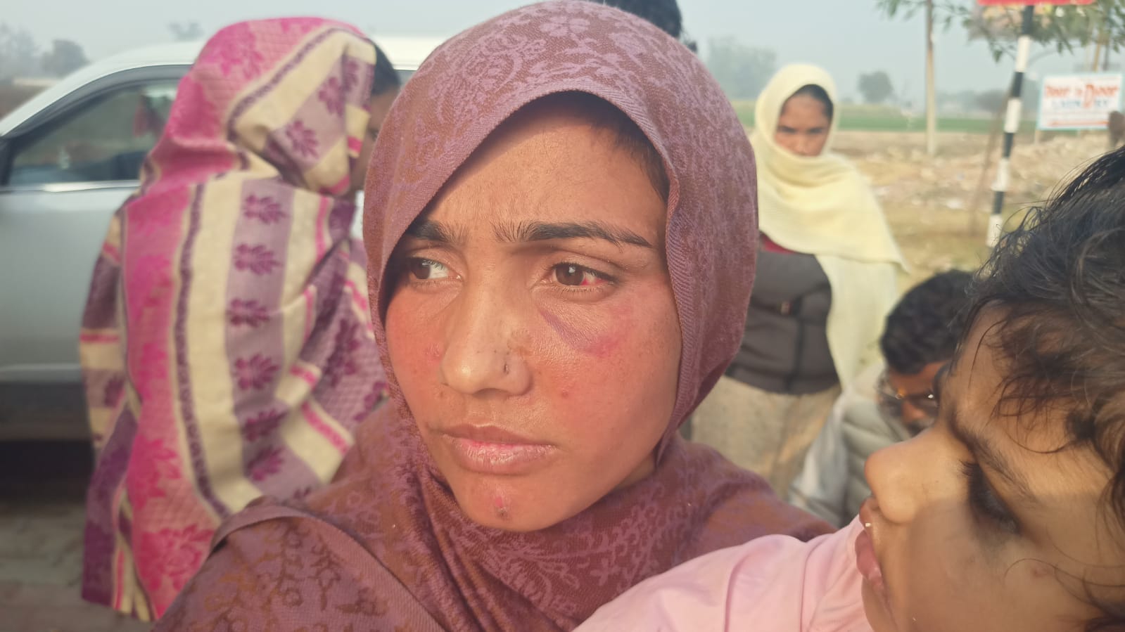 महिला ने दबंगों पर घर में घुसकर मारपीट करने का लगाया आरोप