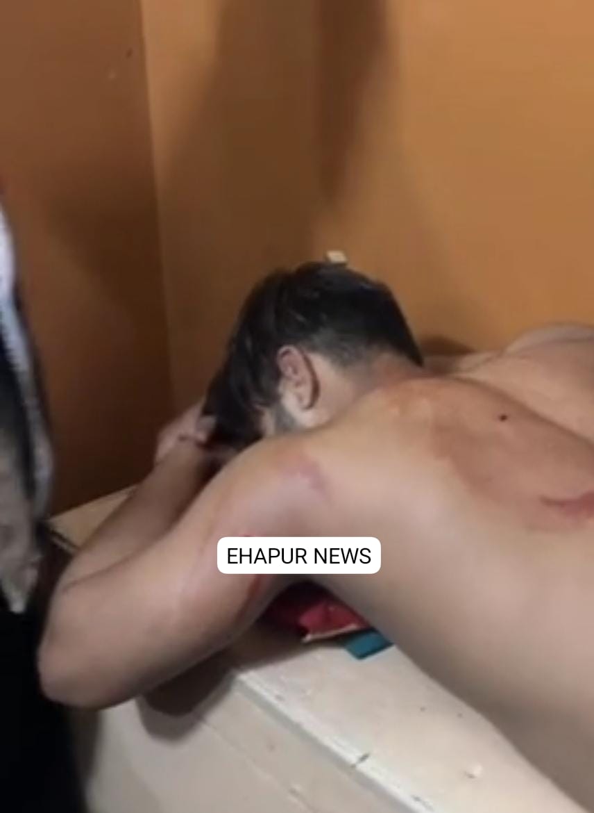 पिलखुवा: गाली-गलौज का विरोध करने पर युवक को जमकर पीटा, पेचकस से किया हमला